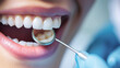 © Anoo - Close Up of Person With Toothbrush