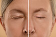 © New Africa - Aging skin changes. Woman showing face before and after rejuvenation, closeup. Collage comparing skin condition
