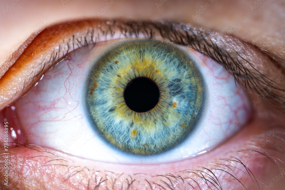 Female Blue-Green Colored Eye with brown pigment spots. Pupil Opened ...