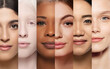 © master1305 - Medical and dermatological materials on skin conditions. Collage. Close-up of beautiful young girls of different nationality and skin colors. Concept of human diversity, beauty standards, cosmetics