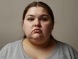 © Olena - Portrait of round fac and excess weight gain indicating obesity.