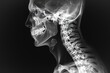 This x-ray image provides a detailed view of the anatomy of a human head and neck, revealing key structures and bone density, Black and white 3D X-ray film of the human neck region, AI Generated