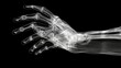 X-ray hand / Many others X-ray images in my portfolio.