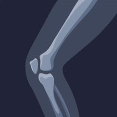 Wall Mural - Human bones orthopedic and skeleton icon, bone x-ray image of human joints, anatomy skeleton flat design illustration