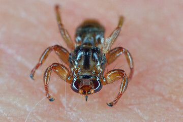 Wall Mural - A macro close-up of parasite Deer fly, Lipoptena cervi, on a hairy sking. It is sometimes called the flying tick.