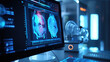 © redflower - Brain test results on a monitor in a laboratory or surgery