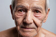 Close-up on face skin of old man, skin exfoliation, dry skin concept