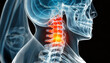 X Ray 3D Rendering - Man with severe pain in the lower spine and intervertebral discs