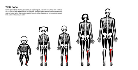 Wall Mural - Tibia bone anatomy