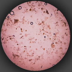 Poster - Giardia lamblia cysts and Trophozoite form, muscle fiber in stool examination, under 40X light microscope, selective focus.