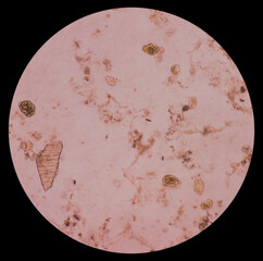 Poster - Giardia lamblia cysts and Trophozoite form, muscle fiber in stool examination, under 40X light microscope, selective focus.