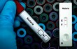 © kitsawet - Blood sample of patient positive tested for malaria by rapid diagnostic test.