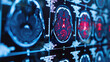 Magnetic resonance imaging MRI, future of medicine scan technology, magnetic field scanning