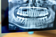 Doctor orthodontists stomatologist examines x-ray of teeth tooth patient jaw AI Generative