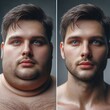 © JR Digital Art - Comparison of man before and after lifestyle change. Fitness and healthy nutrition. Healthy living. Vegan. Regular exercise. Transformation. Weight loss. Loosing Fat. Liposuction. Generative AI