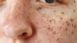 Closeup of Skin with Blackheads and Pores for Dermatological Studies and Treatments