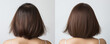 Woman with hair loss and alopecia before and after treatment, hair loss treatment, hair transplantation, on grey background, collage. Reception at a trichologist.