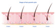 © Mosterpiece - Stages of hair growth cycle vector isolated on white background. Hair grows in four distinct stages. Anagen, growing phase. Catagen, transition phase. Telogen, resting phase. Exogen, shedding phase.