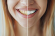 © Alina Zavhorodnii - The difference between yellow and white teeth on a beautiful girl's smile, teeth whitening, dentist