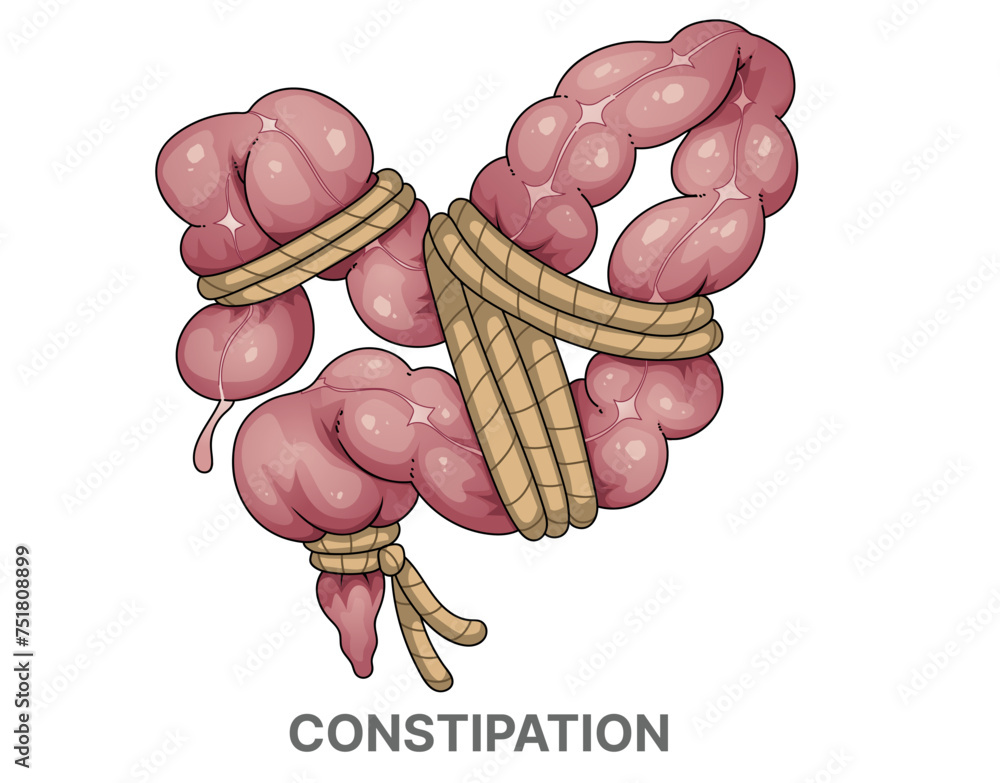 Constipation. Volvulus. Healthcare illustration. Cartoon illustration ...