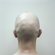 © Scrudje - Human Bald Head from Behind on a White Background. Generative ai