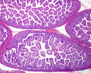 Poster - Fetal small intestine