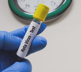 Sticker - Blood sample for Rotavirus test. Scientist holding Rotavirus infected blood in test tube laboratory background.