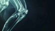 A film x-ray of the left knee lateral view showed the kneecap (patella) bone fracture. The plain film of the femur on a dark background with copy space. Medical concept. Human imaging technology.