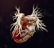 CTA Chest  or CTPA with contrast media 3D rendering  for diagnostic Pulmonary embolism (PE) .