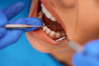 Close up of woman having teeth check-up at dentist's office.