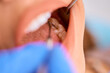 Close up of woman during dental appointment at dentist's office.