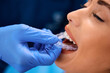 Close up of orthodontist applying invisible aligner on woman's teeth at dental clinic.