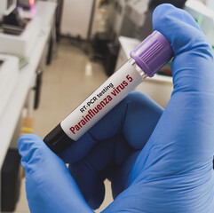 Wall Mural - Blood sample for RT PCR Parainfluenza Virus 5 test.