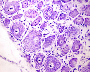 Poster - Neurons. Dorsal root ganglion