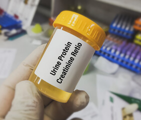 Sticker - Urine Sample for Urine Protein-Creatinine Ratio (UPCR) test, to diagnosis of chronic kidney disease (CKD).