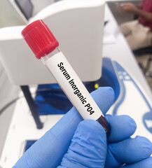 Poster - Blood sample for serum inorganic Phosphate test.