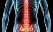 © piai - A back pain on the spine area. Medical illustration style