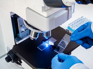 Wall Mural - Hands in blue gloves hold a slide with a ready-made drug for examination under the magnification of a microscope.