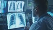 Radiologists assessing lung X-ray scans.