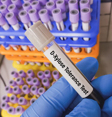 Poster - Blood sample for D-xylose tolerance test, to help diagnose malabsorption disorders, that affect your ability to digest and absorb nutrients from food. xylose absorption test, D-xylose test.