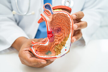 Wall Mural - Stomach disease, doctor with anatomy model for study diagnosis and treatment in hospital.