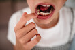 © Maria Manco/Stocksy - young girl points at loose tooth