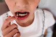 © Maria Manco/Stocksy - young girl points at loose tooth