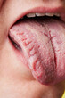 © Joel Forsman/Stocksy - this is what your tongue says about you