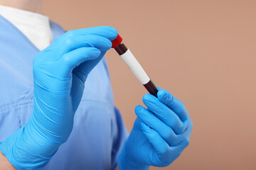 Laboratory testing. Doctor with blood sample in tube on light brown background, closeup. Space for text