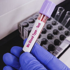 Poster - Technologist hold blood sample for MN blood group system. Sugar-bearing proteins called glycophorins.