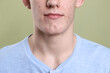 © New Africa - Young man with acne problem on olive background, closeup