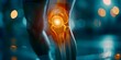 Anatomical image of inflamed knee joint illustrating medical healthcare concept. Concept Medical Illustration, Inflamed Knee Joint, Healthcare Concept, Anatomy Visualization