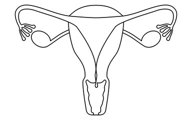 Wall Mural - Diagrammatic illustration of cervical polyps, anatomy of the uterus and ovaries