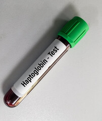 Poster - Blood sample tube with sample for Haptoglobin test, diagnosis for hemolytic anemia and liver disease, hemoglobin-binding protein, HPT, HP test.